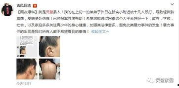 欣悦弟弟爆料了吗视频,幕后真相大曝光